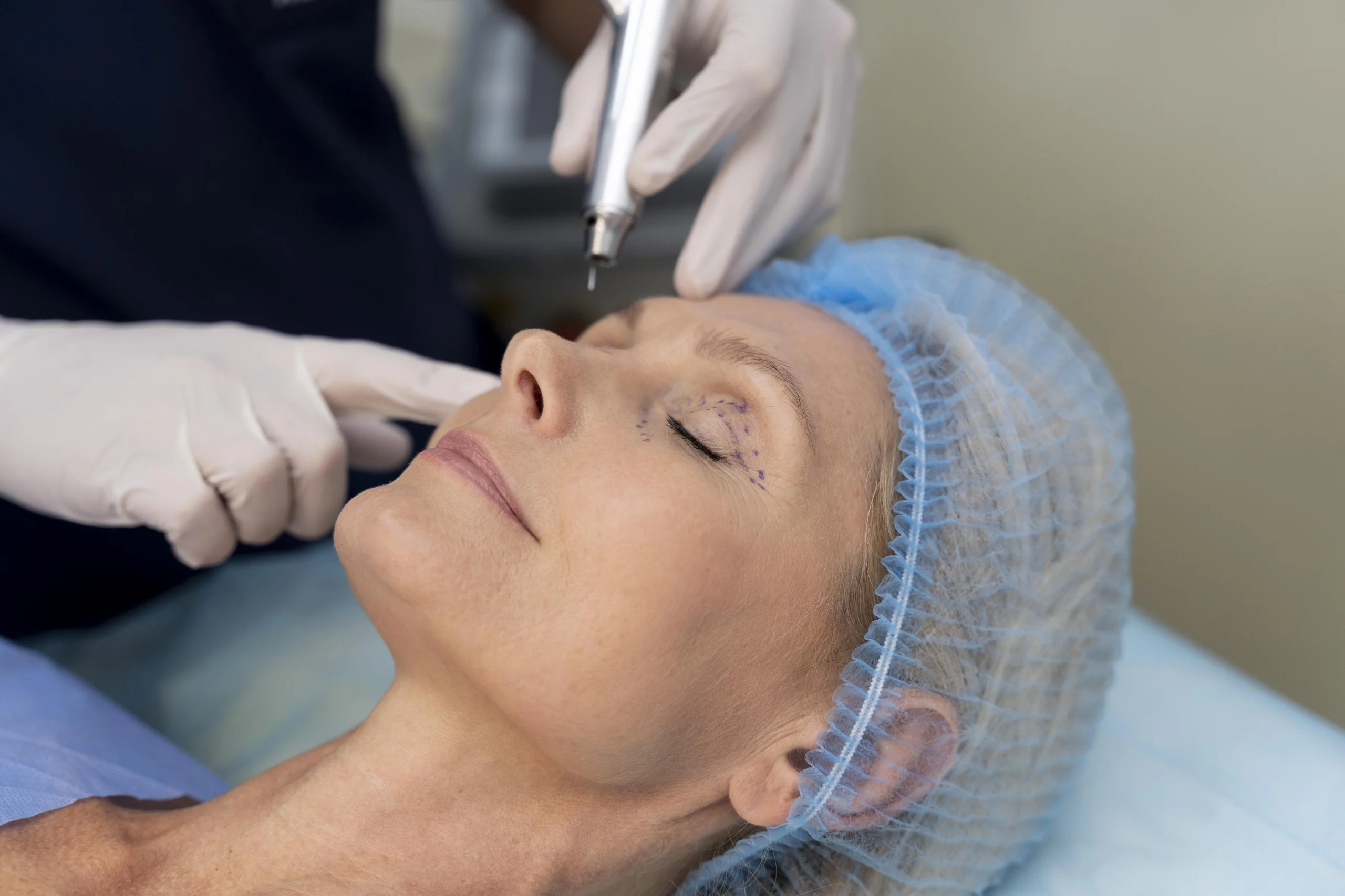 Training Courses Of Botox Dermal Fillers